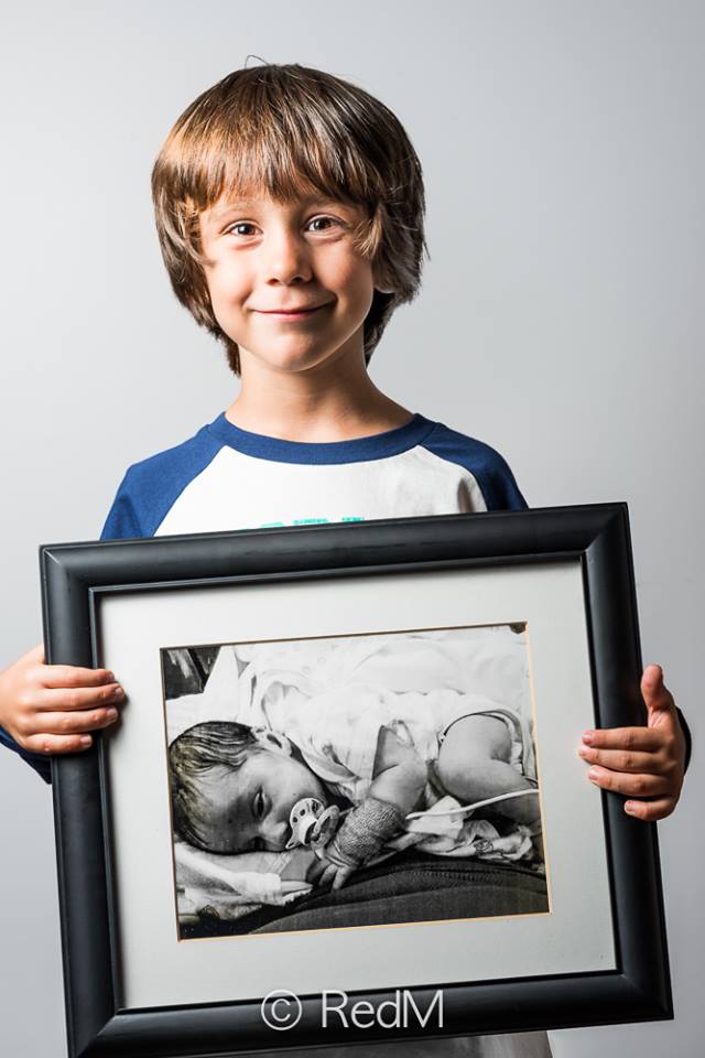 37 Bambini Nati Prematuri che ce l'Hanno Fatta e Mostrano i loro Sorrisi!