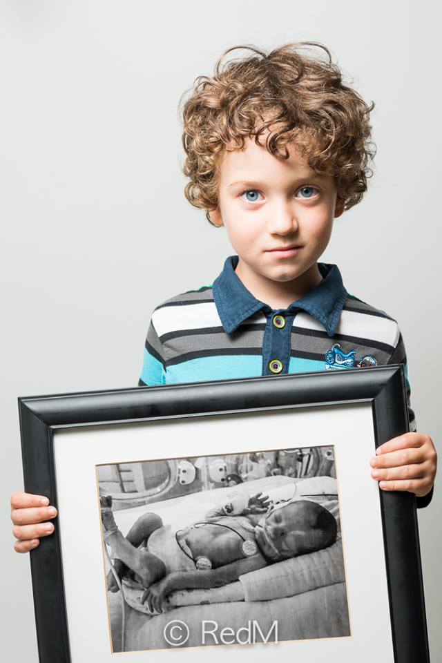 37 Bambini Nati Prematuri che ce l'Hanno Fatta e Mostrano i loro Sorrisi!