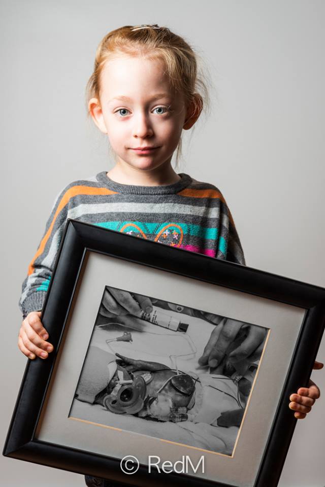 37 Bambini Nati Prematuri che ce l'Hanno Fatta e Mostrano i loro Sorrisi!