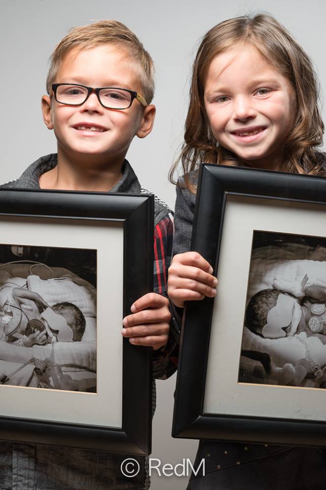 37 Bambini Nati Prematuri che ce l'Hanno Fatta e Mostrano i loro Sorrisi!