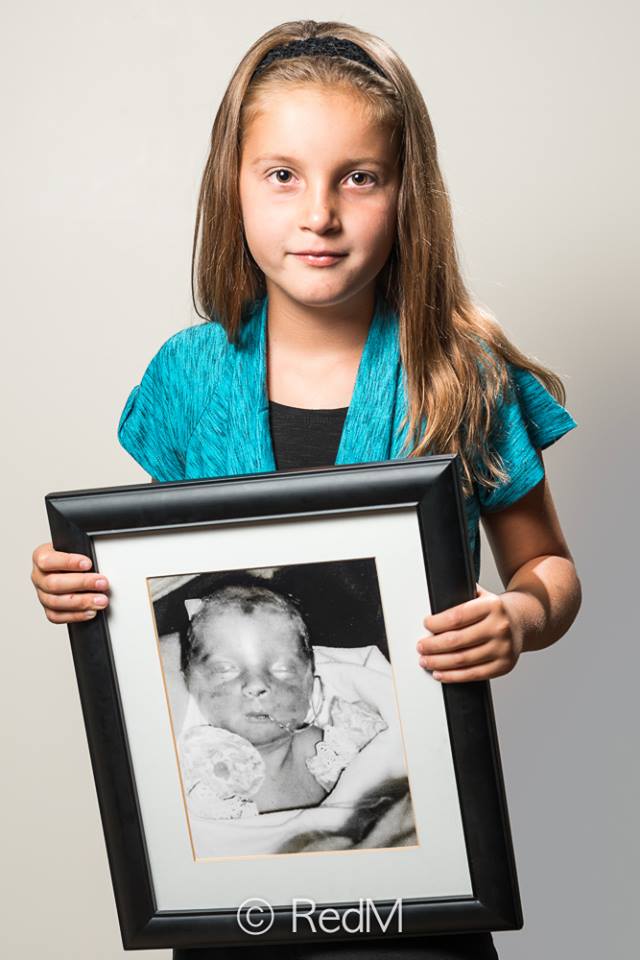 37 Bambini Nati Prematuri che ce l'Hanno Fatta e Mostrano i loro Sorrisi!