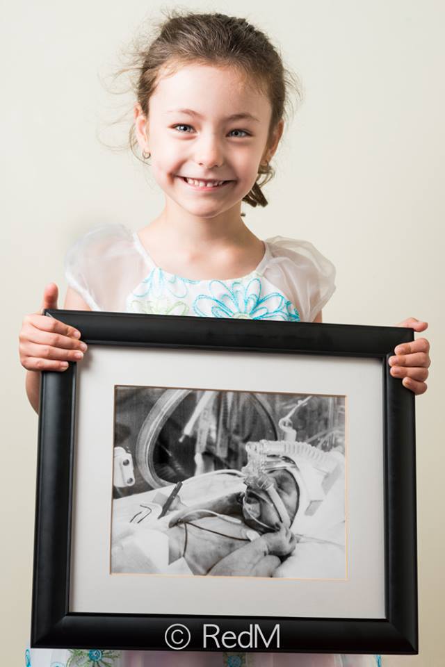 37 Bambini Nati Prematuri che ce l'Hanno Fatta e Mostrano i loro Sorrisi!