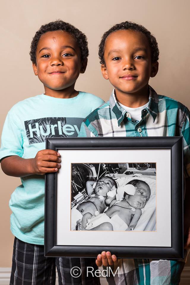 37 Bambini Nati Prematuri che ce l'Hanno Fatta e Mostrano i loro Sorrisi!