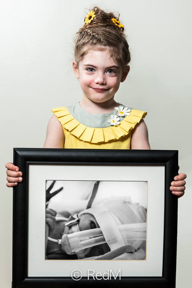 37 Bambini Nati Prematuri che ce l'Hanno Fatta e Mostrano i loro Sorrisi!