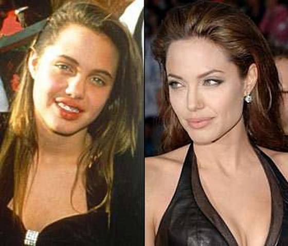 36 Celebrità che Stenterai a Riconoscere: Meglio Prima o Dopo?