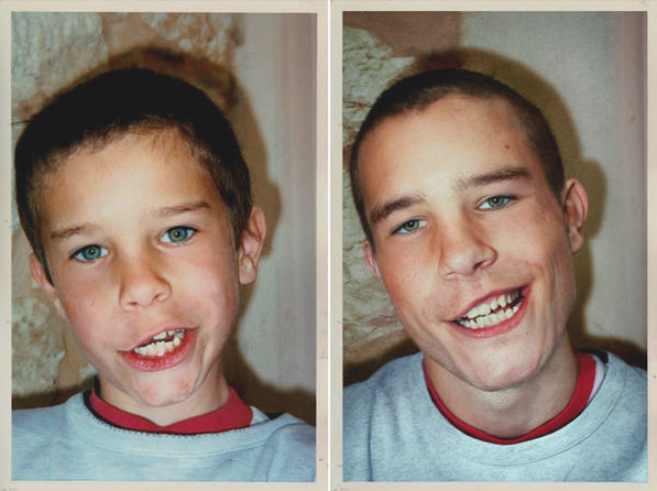 38 Foto d'Infanzia Scattate di Nuovo 20 Anni Dopo: Ecco i Risultati!