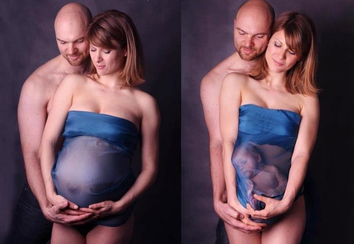 Gravidanza Prima e Dopo: 15 foto Eccezionali che Raccontano la Magia dell'Attesa