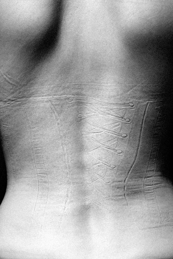 Quando la Ricerca della Bellezza Lascia il Segno: 9 Foto che vi Faranno Riflettere
