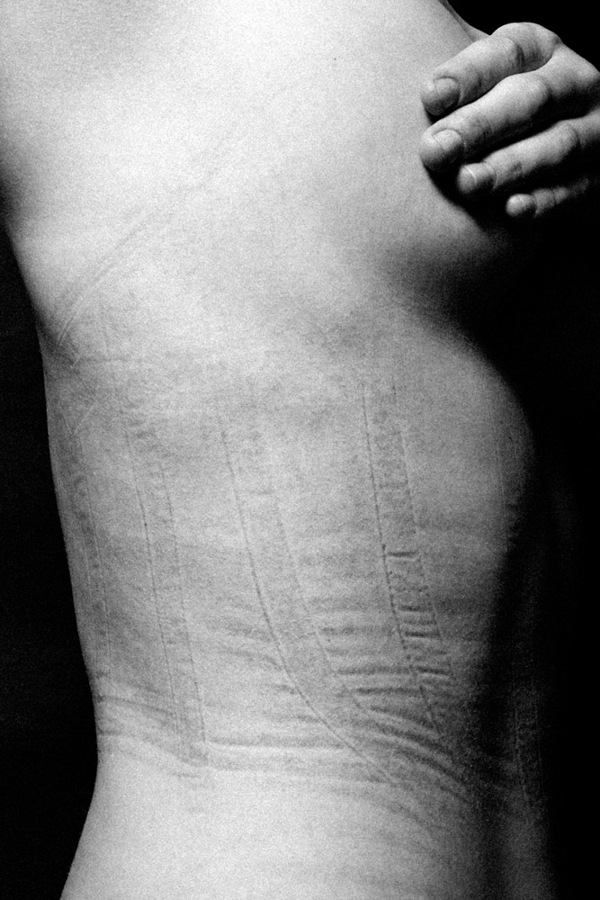 Quando la Ricerca della Bellezza Lascia il Segno: 9 Foto che vi Faranno Riflettere