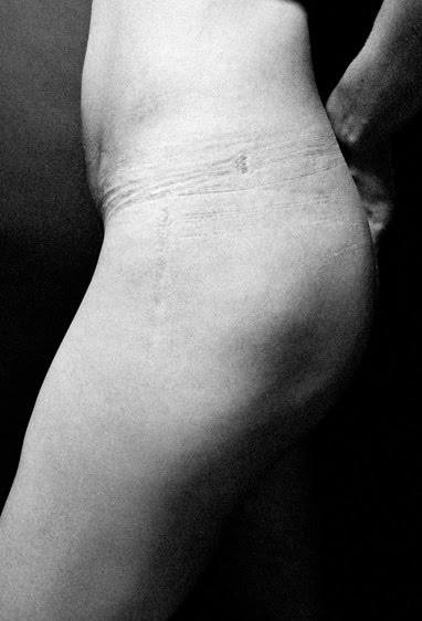Quando la Ricerca della Bellezza Lascia il Segno: 9 Foto che vi Faranno Riflettere