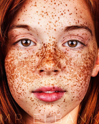 Particolari e Bellissime: 20 Immagini che Catturano il Fascino delle Lentiggini Particolari e Bellissime: 20 Immagini che Catturano il Fascino delle Lentiggini