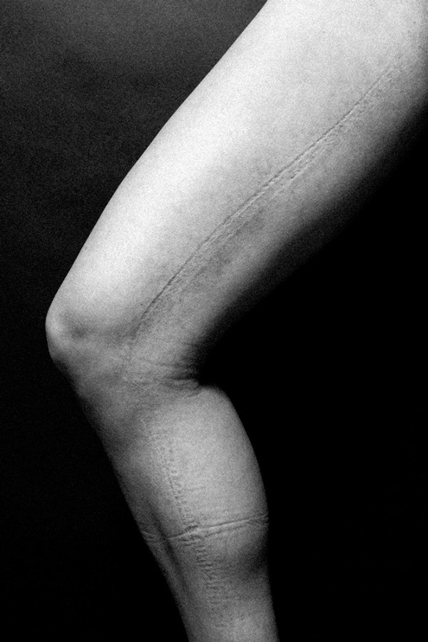 Quando la Ricerca della Bellezza Lascia il Segno: 9 Foto che vi Faranno Riflettere