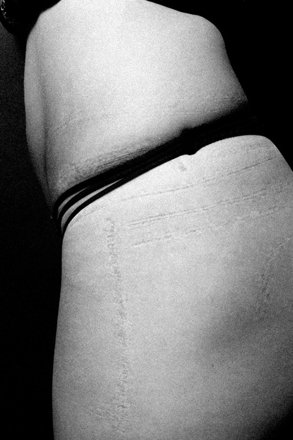 Quando la Ricerca della Bellezza Lascia il Segno: 9 Foto che vi Faranno Riflettere