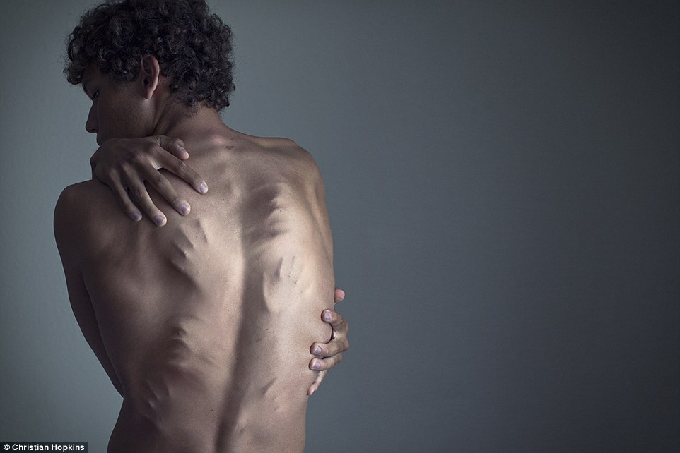 Cosa Significa Soffrire Di Depressione: Lo Dimostrano Queste 28 Foto