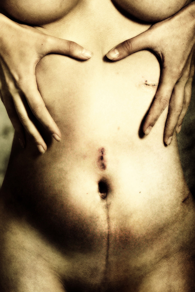 Scars of Life: le Toccanti Storie di 20 Donne "Scritte" con le Cicatrici