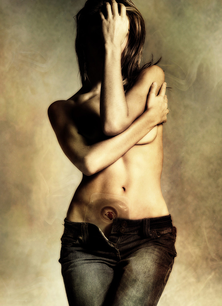 Scars of Life: le Toccanti Storie di 20 Donne "Scritte" con le Cicatrici