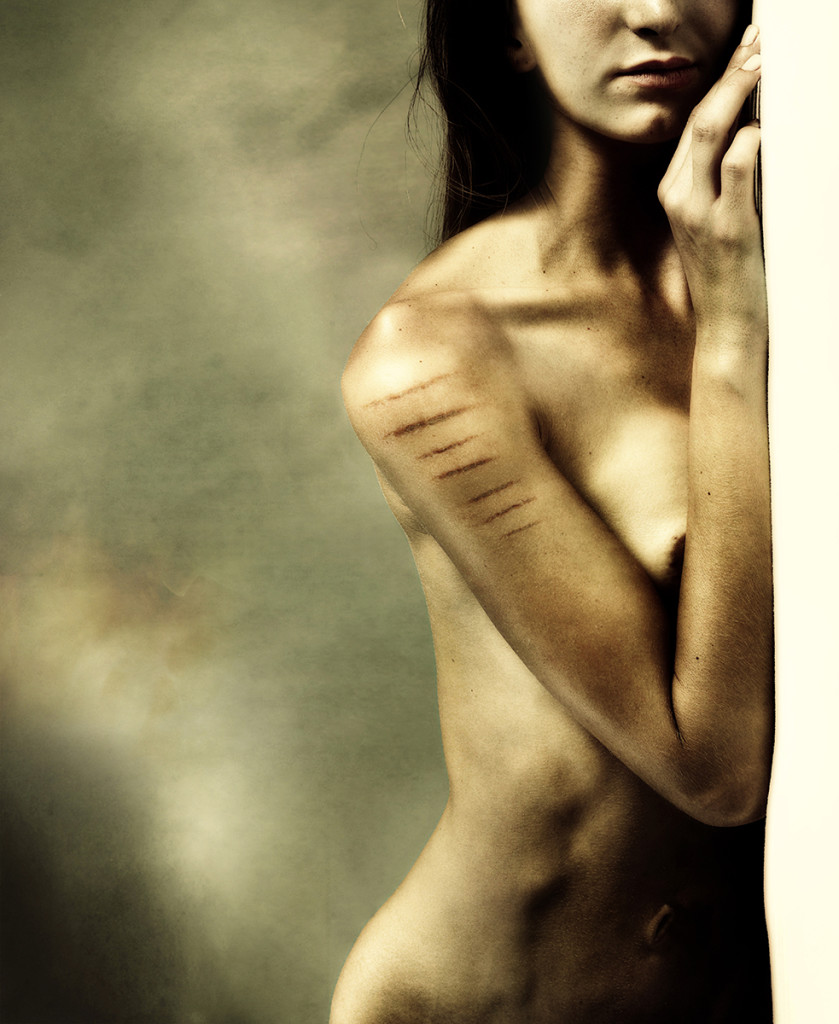Scars of Life: le Toccanti Storie di 20 Donne "Scritte" con le Cicatrici