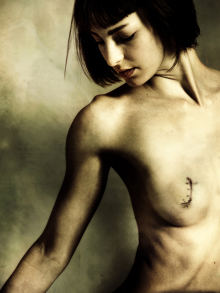 Scars of Life: le Toccanti Storie di 20 Donne "Scritte" con le Cicatrici