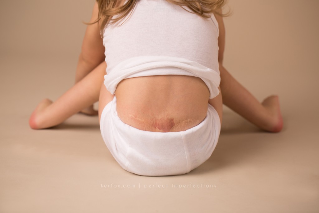 20 Mamme Condividono le Loro "Perfette Imperfezioni" in un Progetto Fotografico