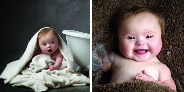 Miracoli in Corso: il Progetto Fotografico per Sostenere i Bimbi con la Sindrome di Down Miracoli in Corso: il Progetto Fotografico per Sostenere i Bimbi con la Sindrome di Down