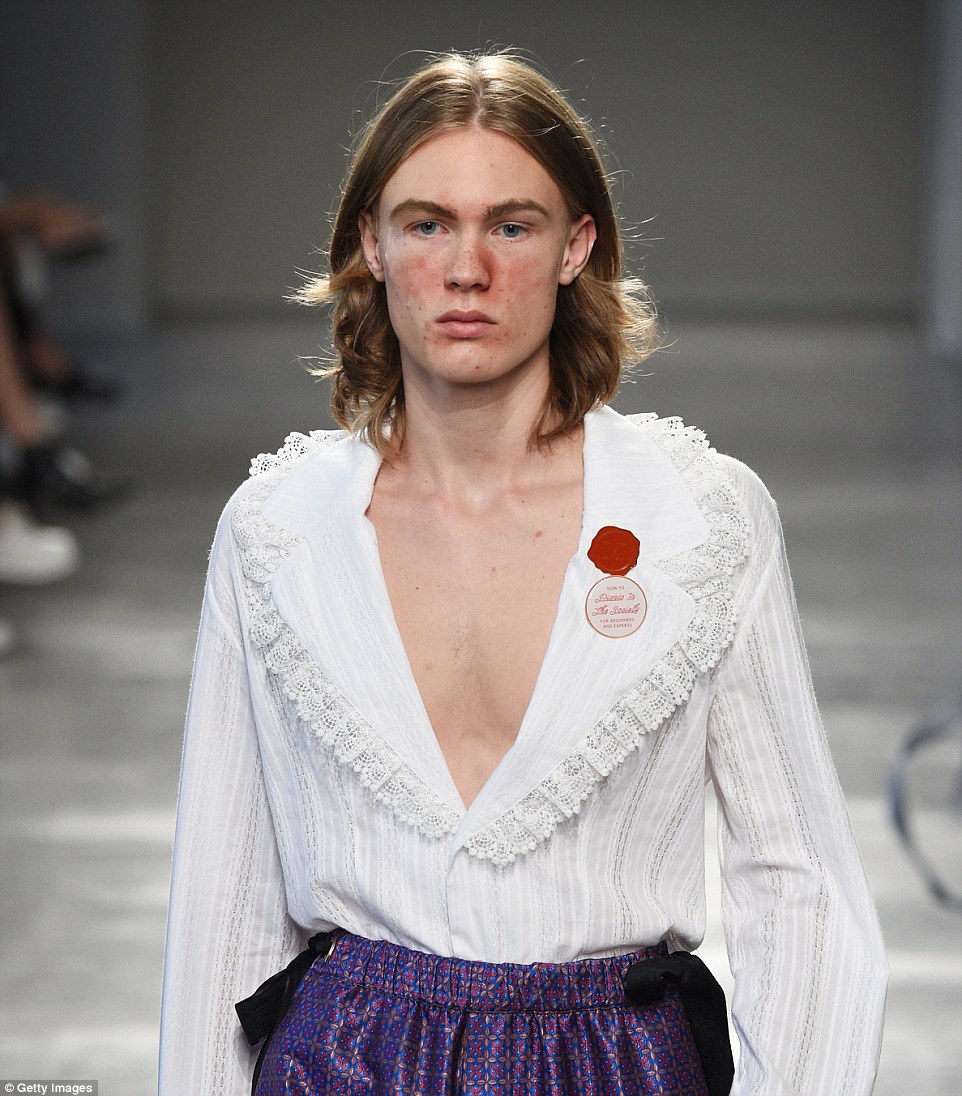 Nuova moda o provocazione: ecco perché a Milano sfilano i modelli con l'acne