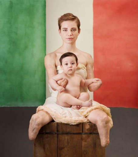 "Vaccinate i vostri bambini": gli scatti di Anne Geddes con Bebe Vio e gli atleti paralimpici contro la meningite