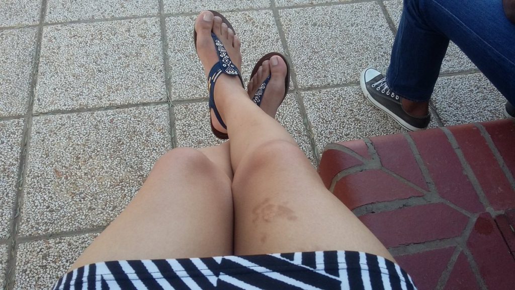 Ecco perché le donne di tutto il mondo stanno condividendo le foto delle loro cosce senza filtri