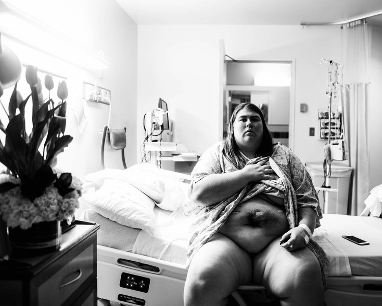 "Mi sono scattata foto nuda per documentare la mia perdita di peso. Ecco perché l'ho fatto"