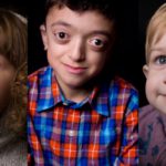 SameButDifferent: le foto dei bambini con malattie rare contro i pregiudizi