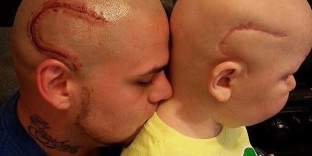 24 geniali tatuaggi fatti con l'aiuto di nei, macchie o malattie della pelle