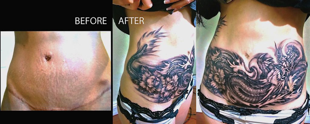 24 geniali tatuaggi fatti con l'aiuto di nei, macchie o malattie della pelle