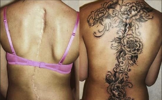 24 geniali tatuaggi fatti con l'aiuto di nei, macchie o malattie della pelle