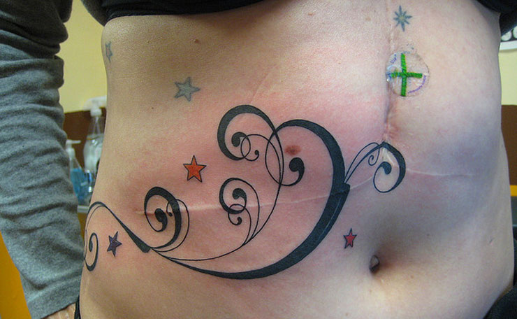 24 geniali tatuaggi fatti con l'aiuto di nei, macchie o malattie della pelle