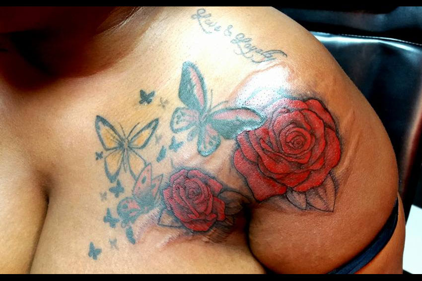 24 geniali tatuaggi fatti con l'aiuto di nei, macchie o malattie della pelle