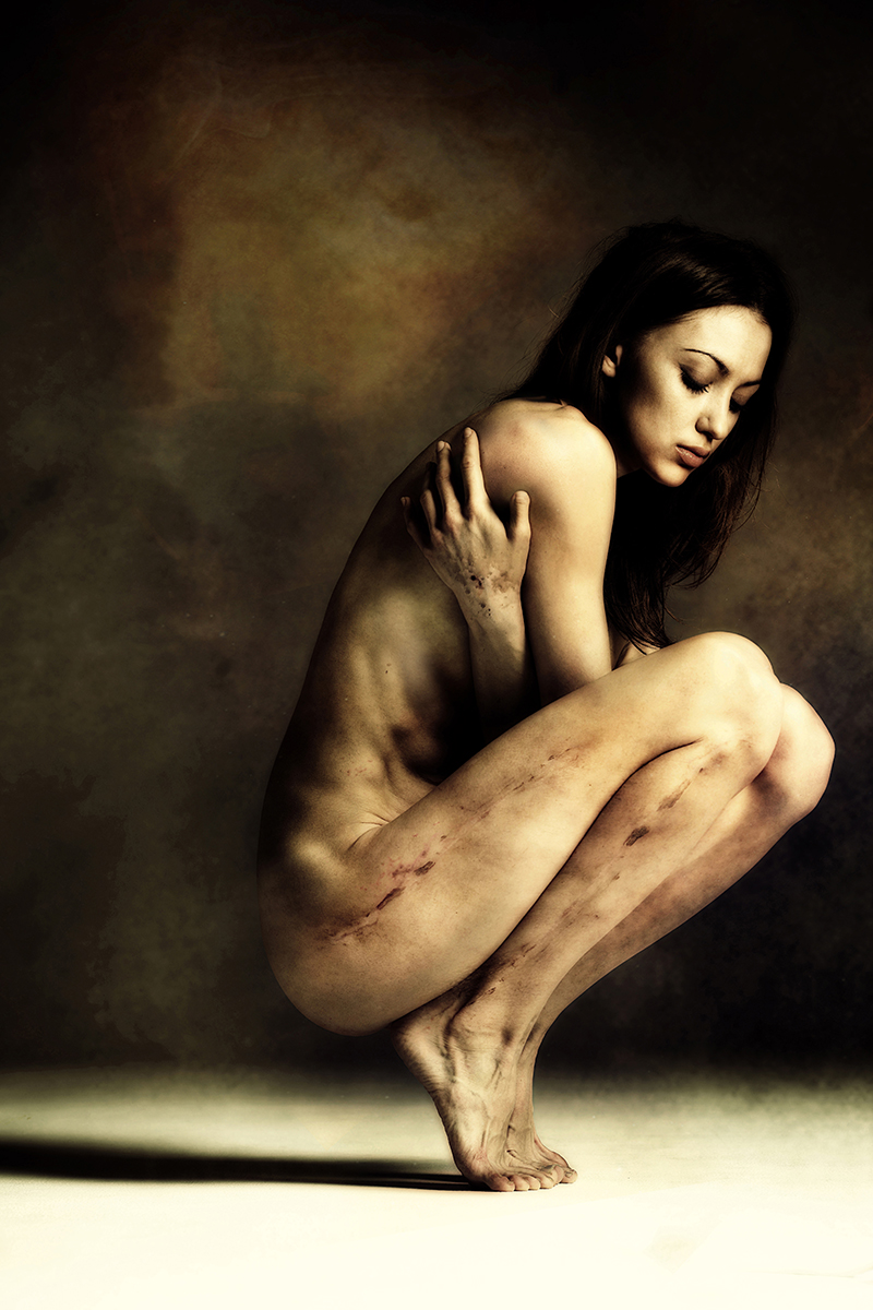 "Scars of life": cartoline dall'inferno (e ritorno) di 26 donne