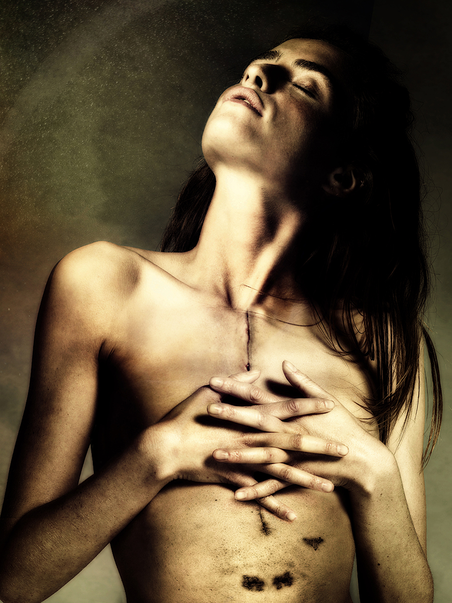 "Scars of life": cartoline dall'inferno (e ritorno) di 26 donne