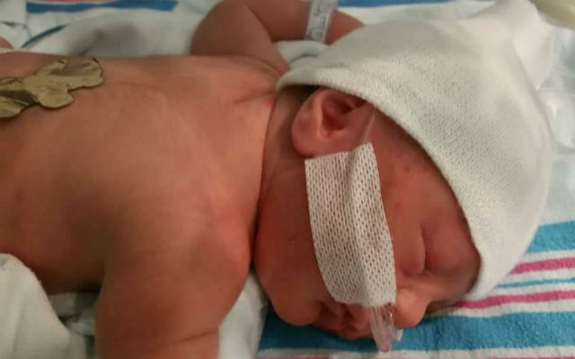 Felici di essere vivi. Il sorriso della neonata prematura e dei suoi amici