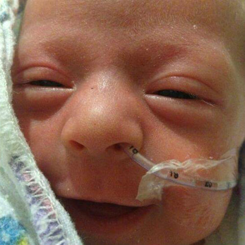 Felici di essere vivi. Il sorriso della neonata prematura e dei suoi amici