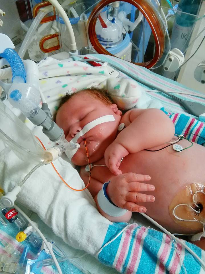 Felici di essere vivi. Il sorriso della neonata prematura e dei suoi amici