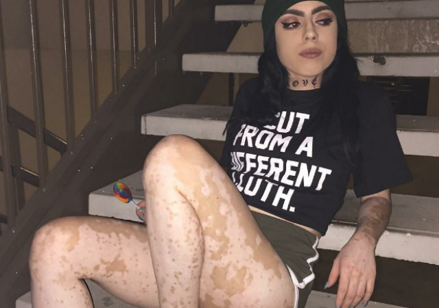 La rivincita di Ashley, la ragazza con il mondo disegnato sulla pelle