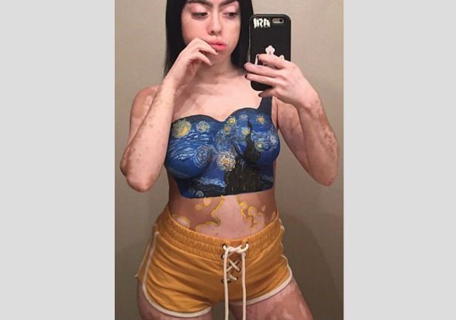 La rivincita di Ashley, la ragazza con il mondo disegnato sulla pelle