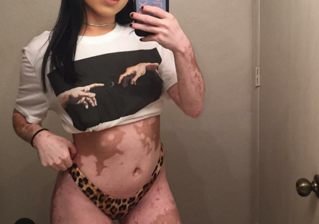 La rivincita di Ashley, la ragazza con il mondo disegnato sulla pelle