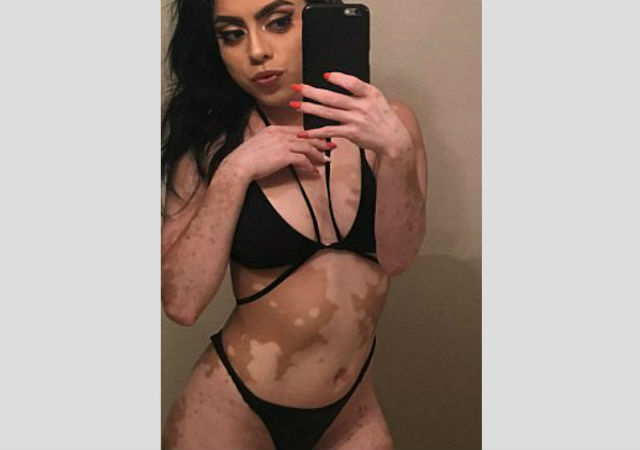 La rivincita di Ashley, la ragazza con il mondo disegnato sulla pelle