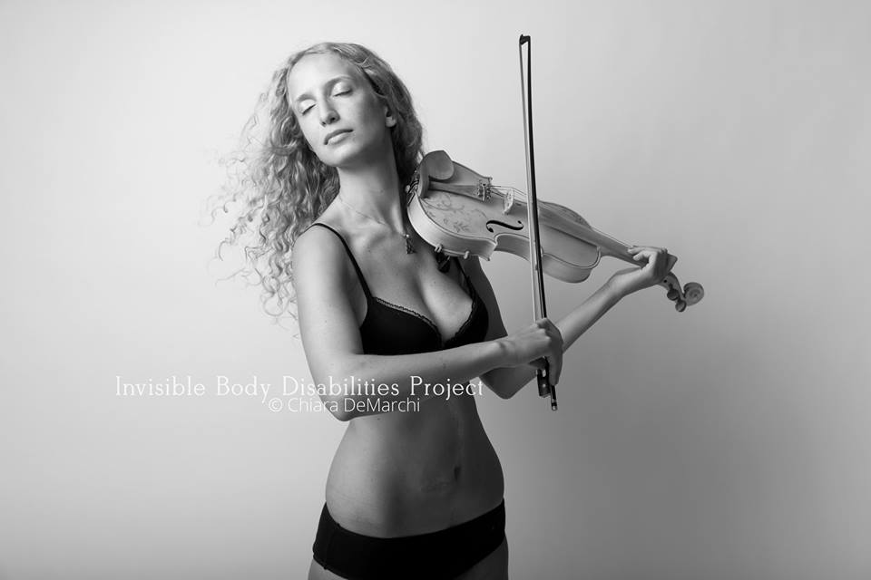 Invisible Body Disabilities, la bellezza delle guerriere che non si nascondono