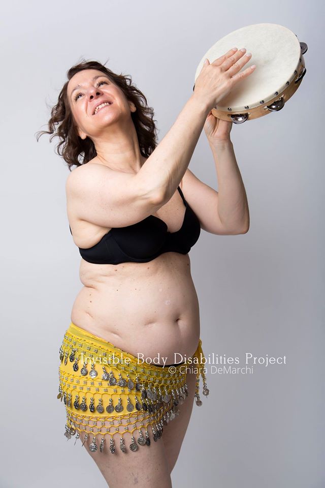 Invisible Body Disabilities, la bellezza delle guerriere che non si nascondono