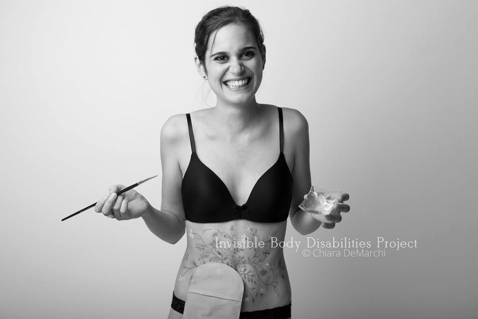 Invisible Body Disabilities, la bellezza delle guerriere che non si nascondono