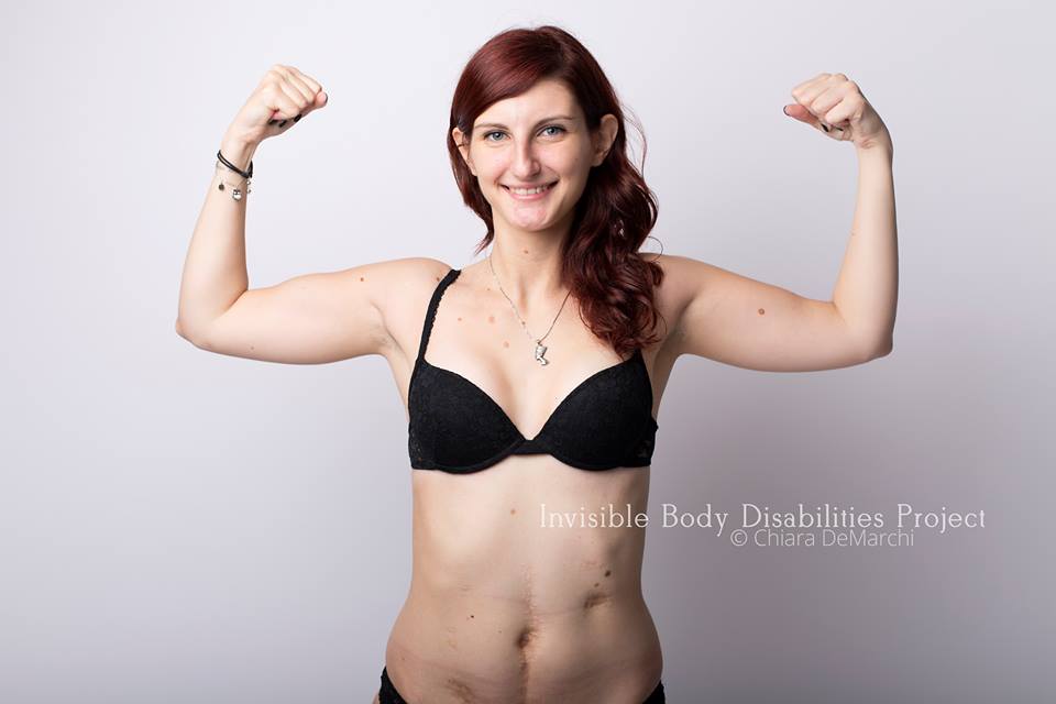 Invisible Body Disabilities, la bellezza delle guerriere che non si nascondono