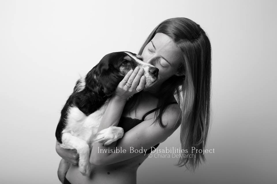 Invisible Body Disabilities, la bellezza delle guerriere che non si nascondono