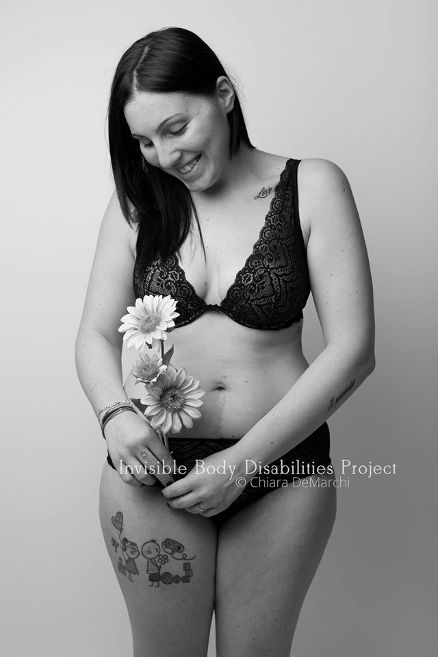 Invisible Body Disabilities, la bellezza delle guerriere che non si nascondono