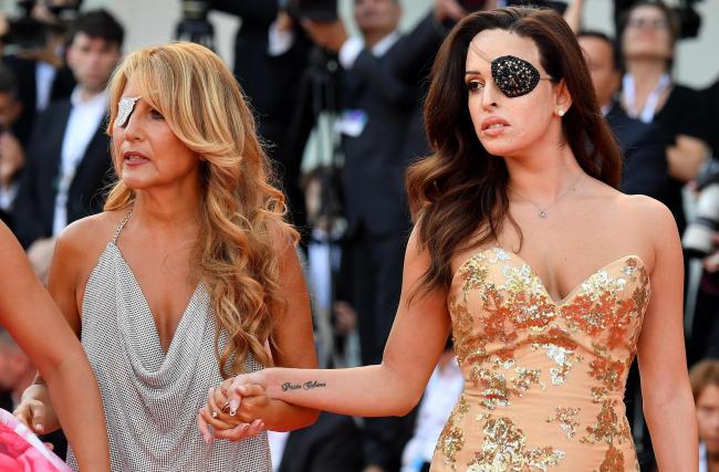 "Tu con l'uncino, io con la benda": la forza di Gessica Notaro e Valentina Pitzalis